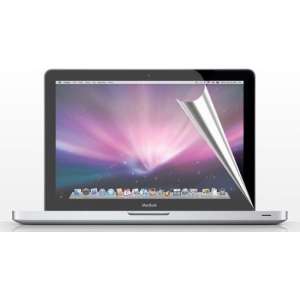Xssive Screen Protector voor MacBook Pro met Retina 13 inch