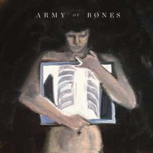 Army of Bones